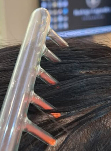 Tratamentos de Alta Frequência Capilar