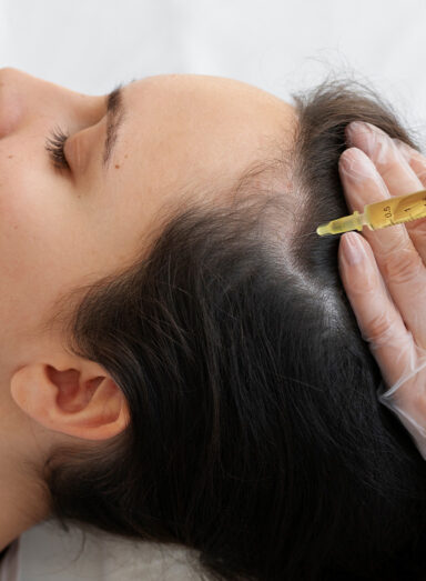 Tratamentos para Terapias Regenerativas Capilares